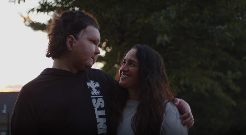 Joe DiMeo, a vascularized composite allotransplantation (VCA) face and double hand transplant recipient wraps his arm around his wife, smiling.